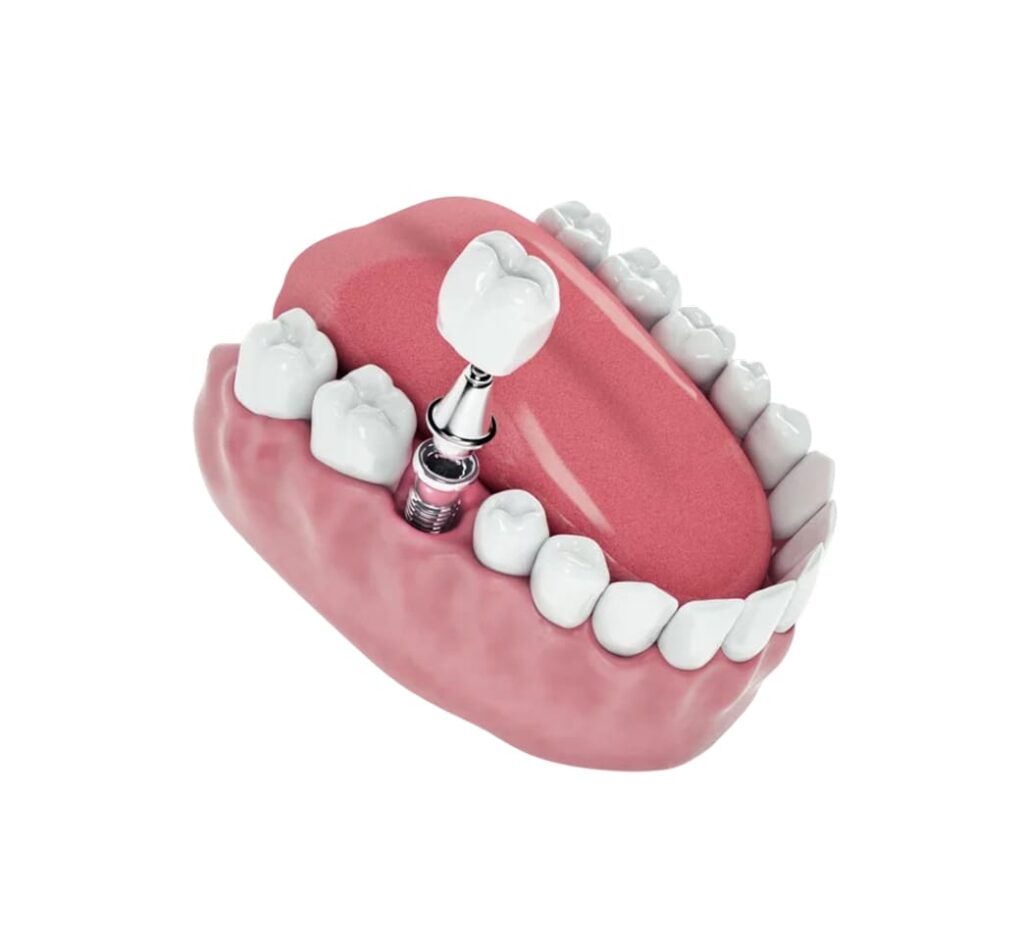 Clínica Lemony - Dr. Leonardo Rosalen - Imagem - Serviço - 014